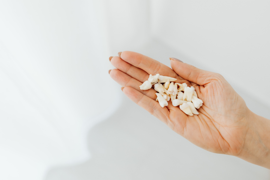 teeth falling out in a dream. a women holding teeth
